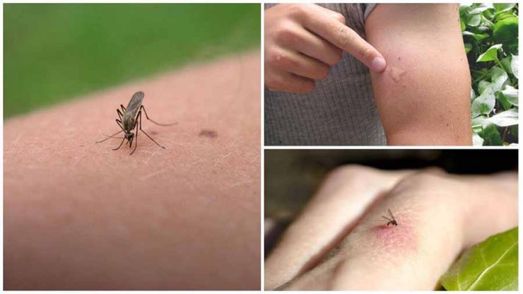 От укусов комаров в домашних - картинка 1
